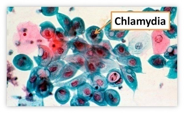 Xét nghiệm chlamydia